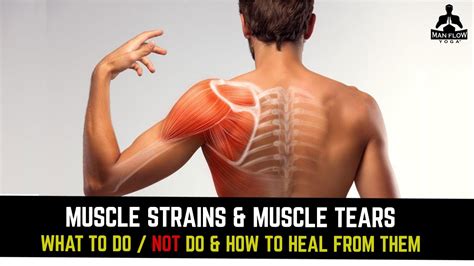 test for muscle tear|muscle strains before and after.